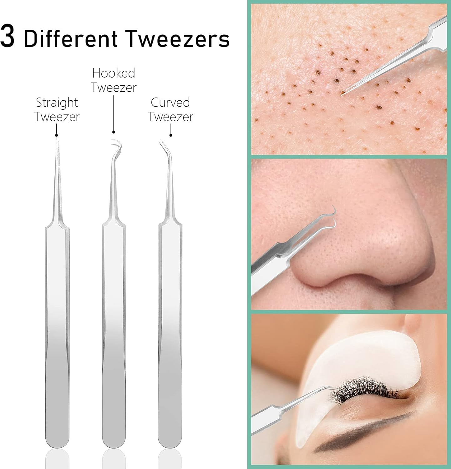 Blackhead Remover Tool Kit 8-in-1