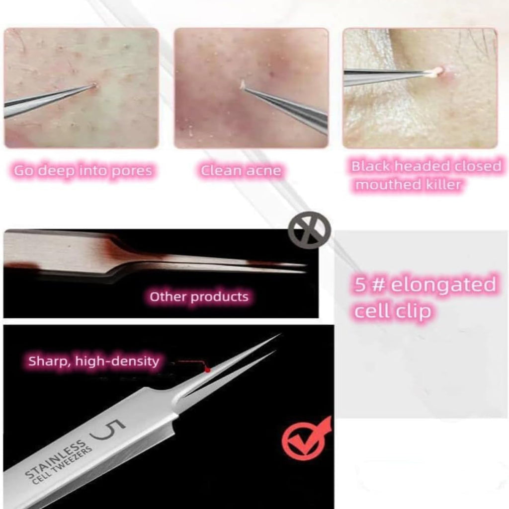 Black Head Remover Tool Kit 3 Pcs