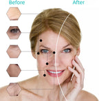Chin Strap Jawline Shaper